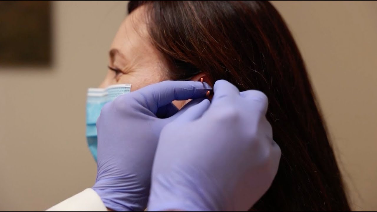 Acupuncture and Breast Cancer Treatment