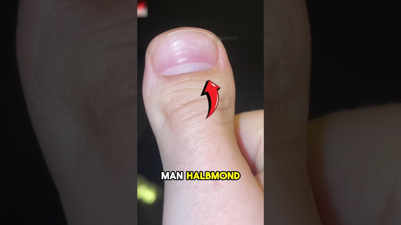 Warum erscheinen diese seltsamen Flecken auf den N&auml;geln? #shortvideo