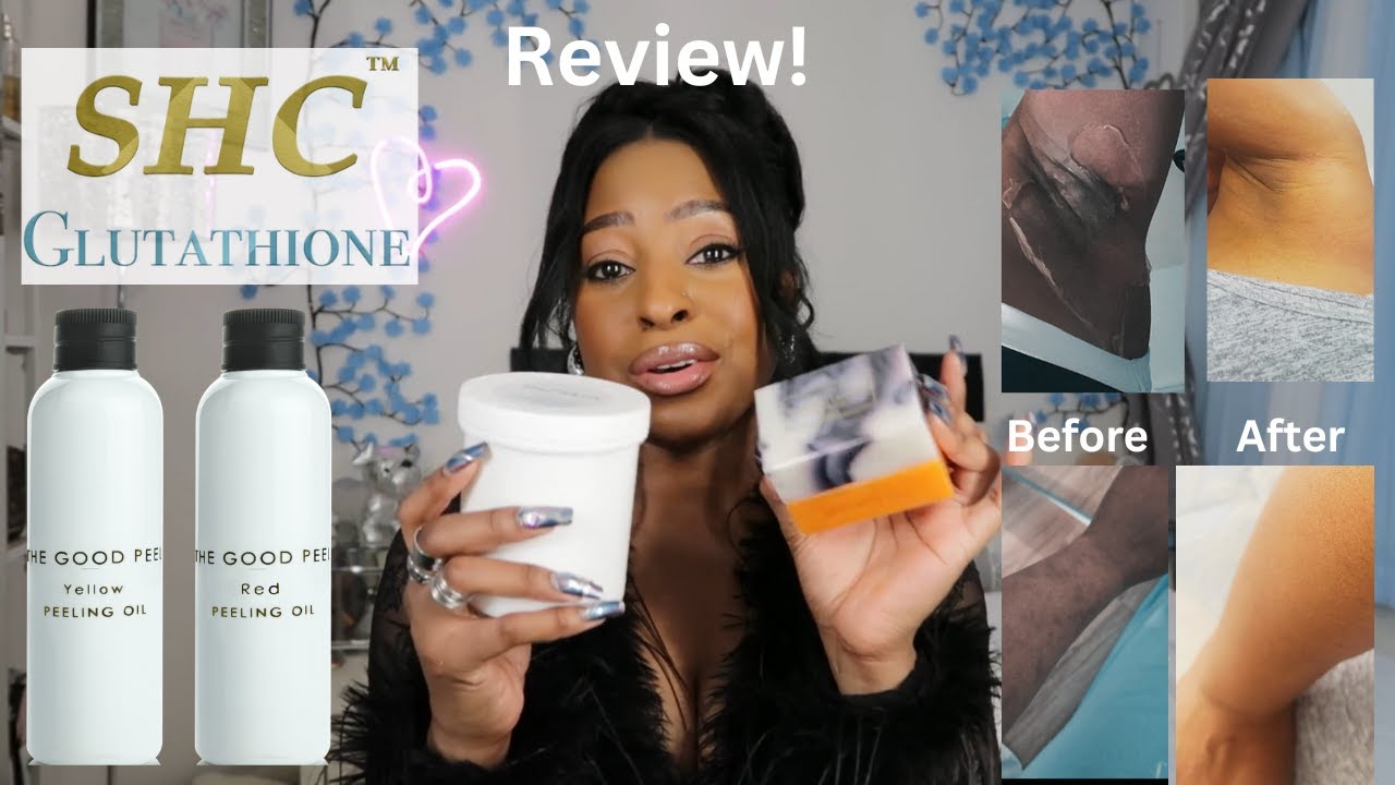 SHC Glutathione Skin Lightening & Skin Brightening Products/Hyperpigmentation. Peeling Oil Review!