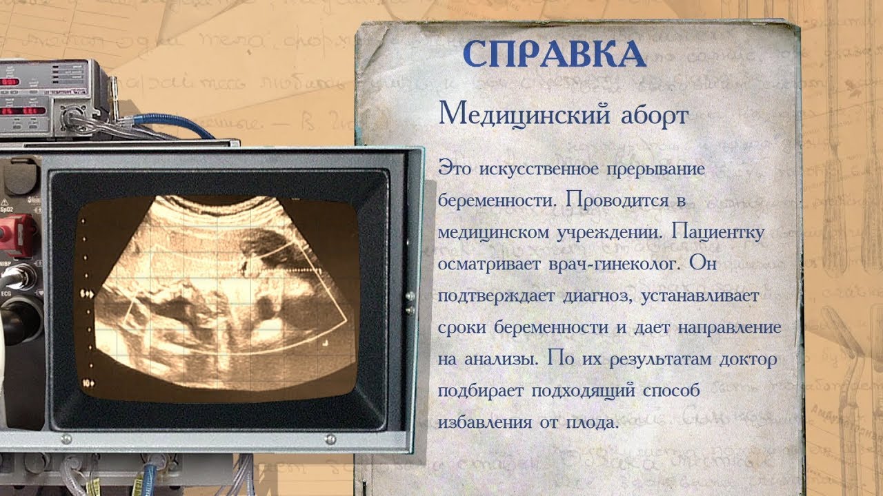 «История болезни». Аборты
