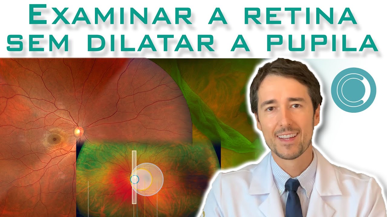 Para examinar a retina é obrigatório dilatar a pupila?