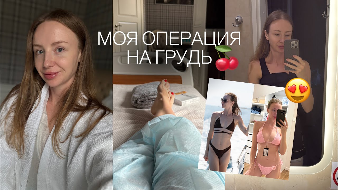 УВЕЛИЧИЛА ГРУДЬ | МАММОПЛАСТИКА | ОПЕРАЦИЯ И РЕАБИЛИТАЦИЯ