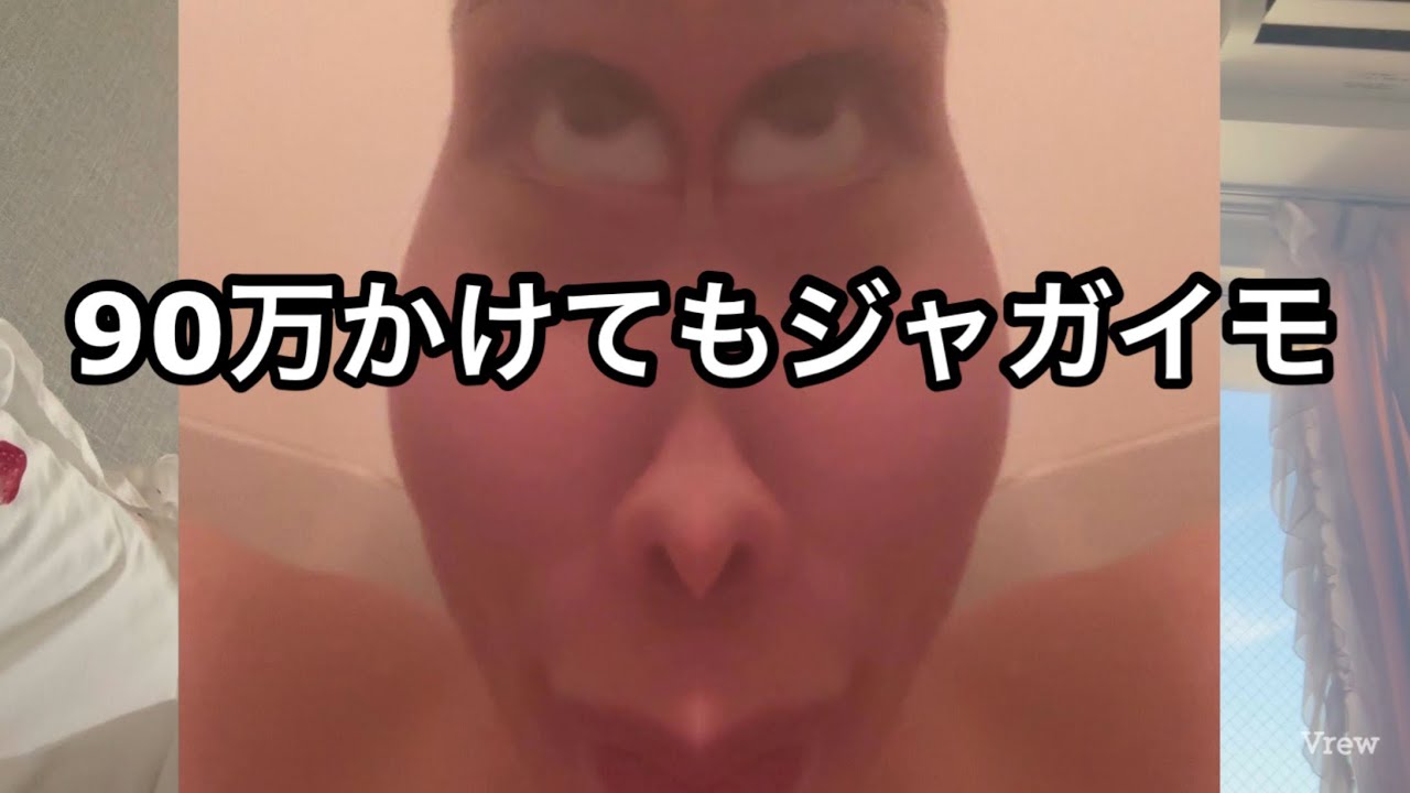 整形体験談と自分の考えを語るよ❣️