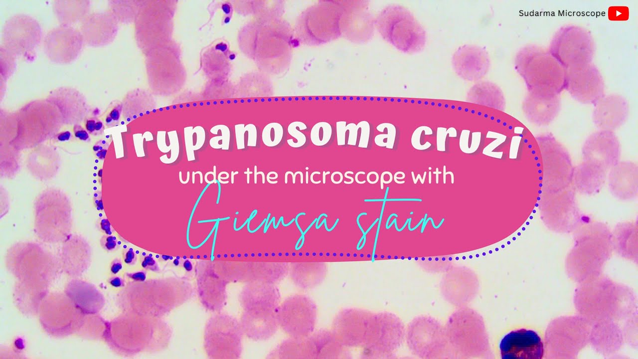 Trypanosoma cruzi under the microscope with Giemsa stain