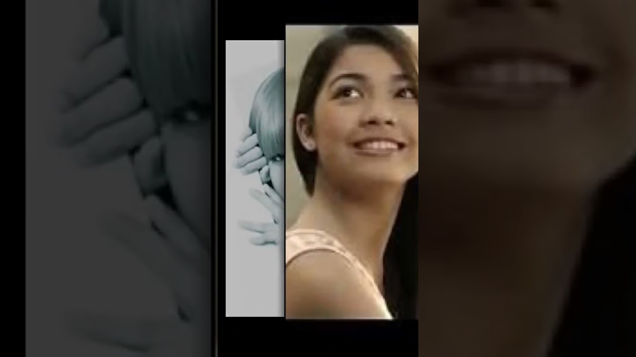 Jane De Leon before and after