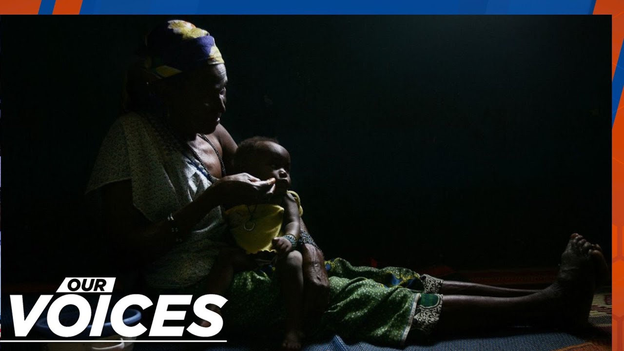 Our Voices 527: The Burden of Obstetric Fistula
