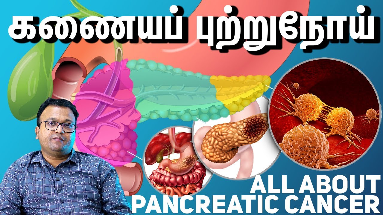 All about pancreatic cancer கணையப் புற்றுநோய் Dr. Dayananda Srinivasan