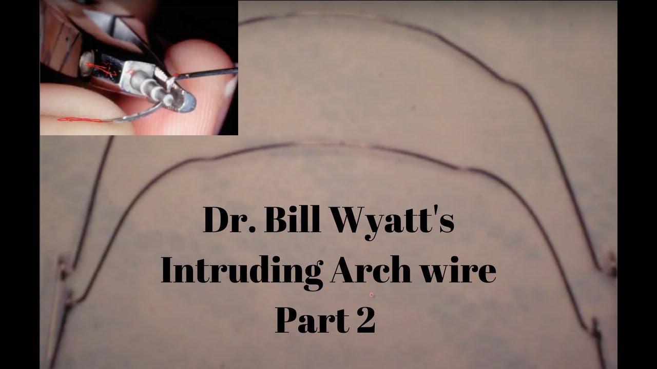 Dr.Bill Wyatt Intruding Arch wires: Making the Bill Wyatt Intruding Arch (2 of 6)
