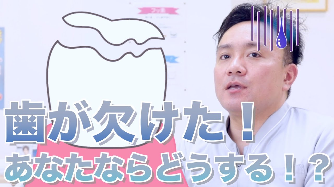 【歯が欠けた】歯科医師が教える正しい対処法