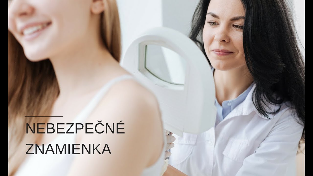 Ktoré znamienka sú nebezpečné?