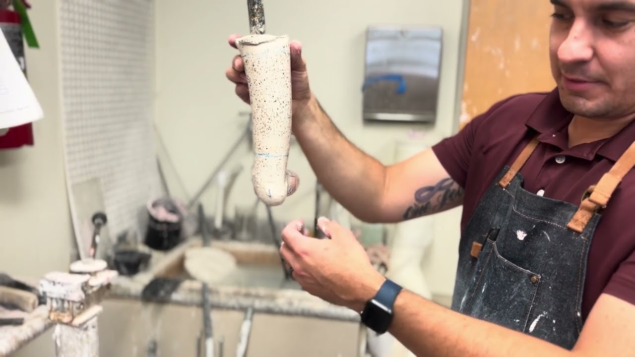 AFO Modification, addition of plaster