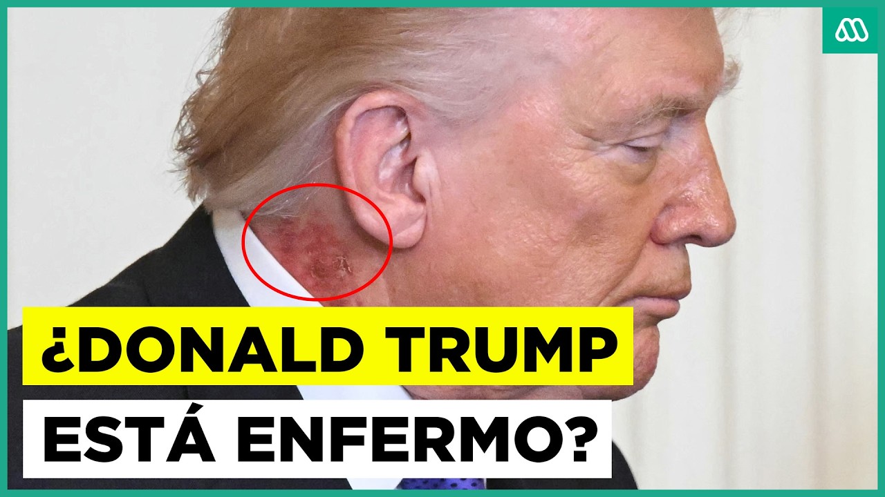 &iquest;Est&aacute; enfermo? Alerta por estado de salud de Donald Trump