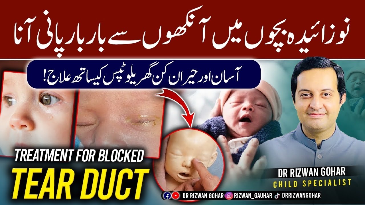 The Ultimate Baby Tears Solution: Tear Duct Exercise #tearduct #massage #exercise