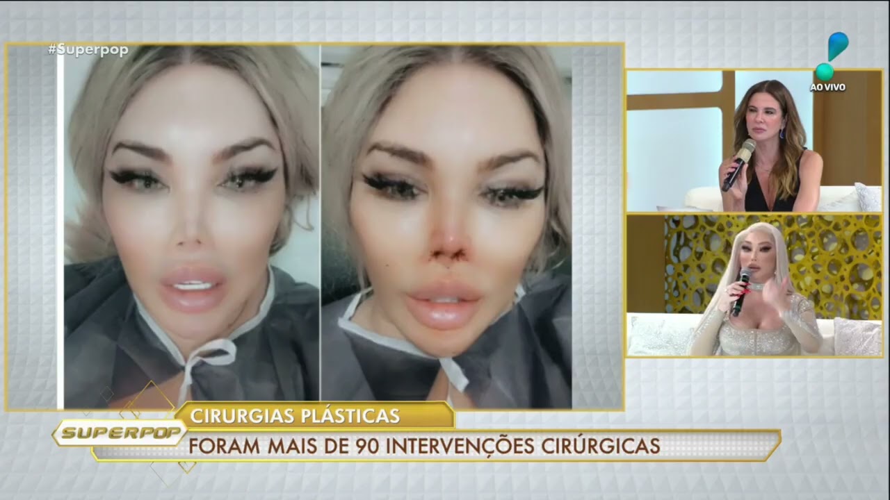 Quando dizer “não” na cirurgia plástica: Botched, caso Jessica Alves e o movimento quiet beauty
