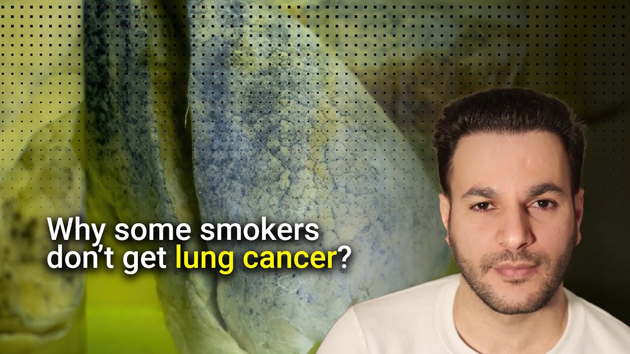 Why some smokers don&rsquo;t get lung cancer?