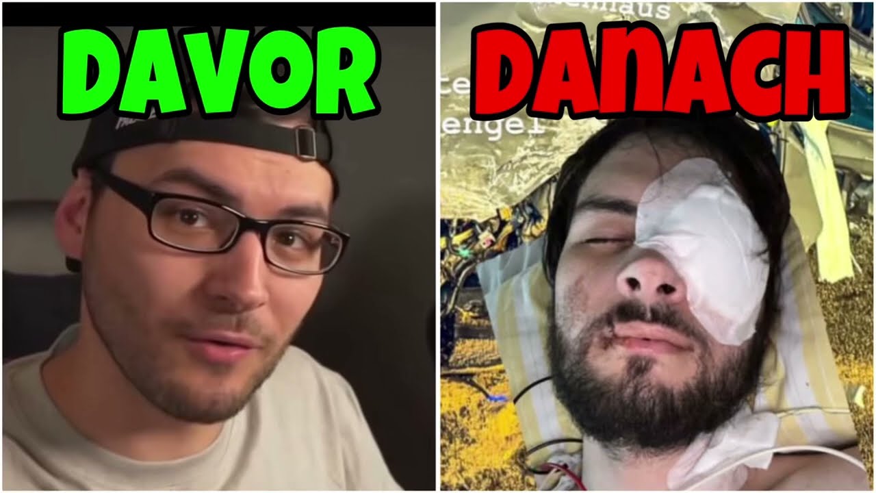 LarsOderSo Hatte einen Unfall ! (Krankenhaus)