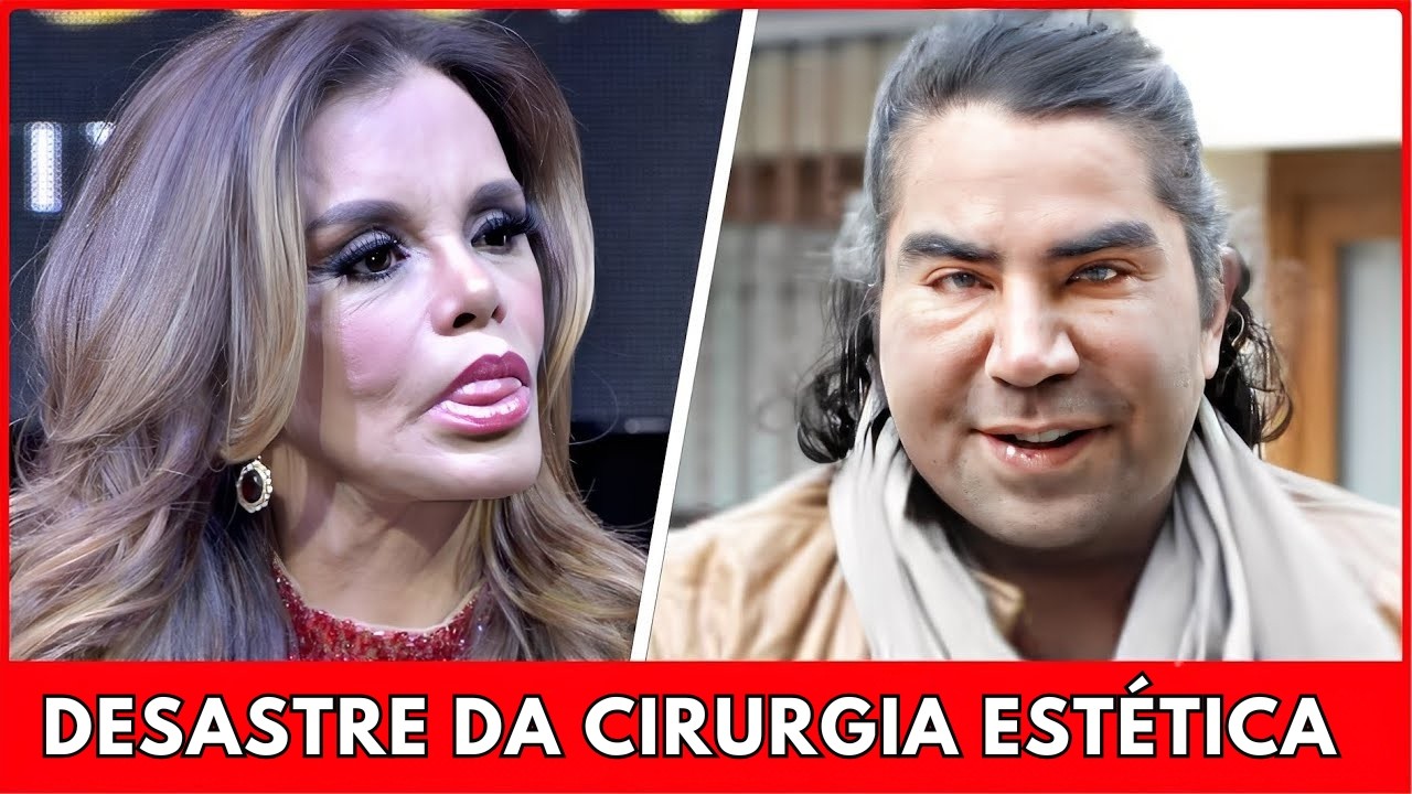 Top 7 Cirurgias Plásticas Mais Polêmicas de Famosos Latinos | Antes e Depois