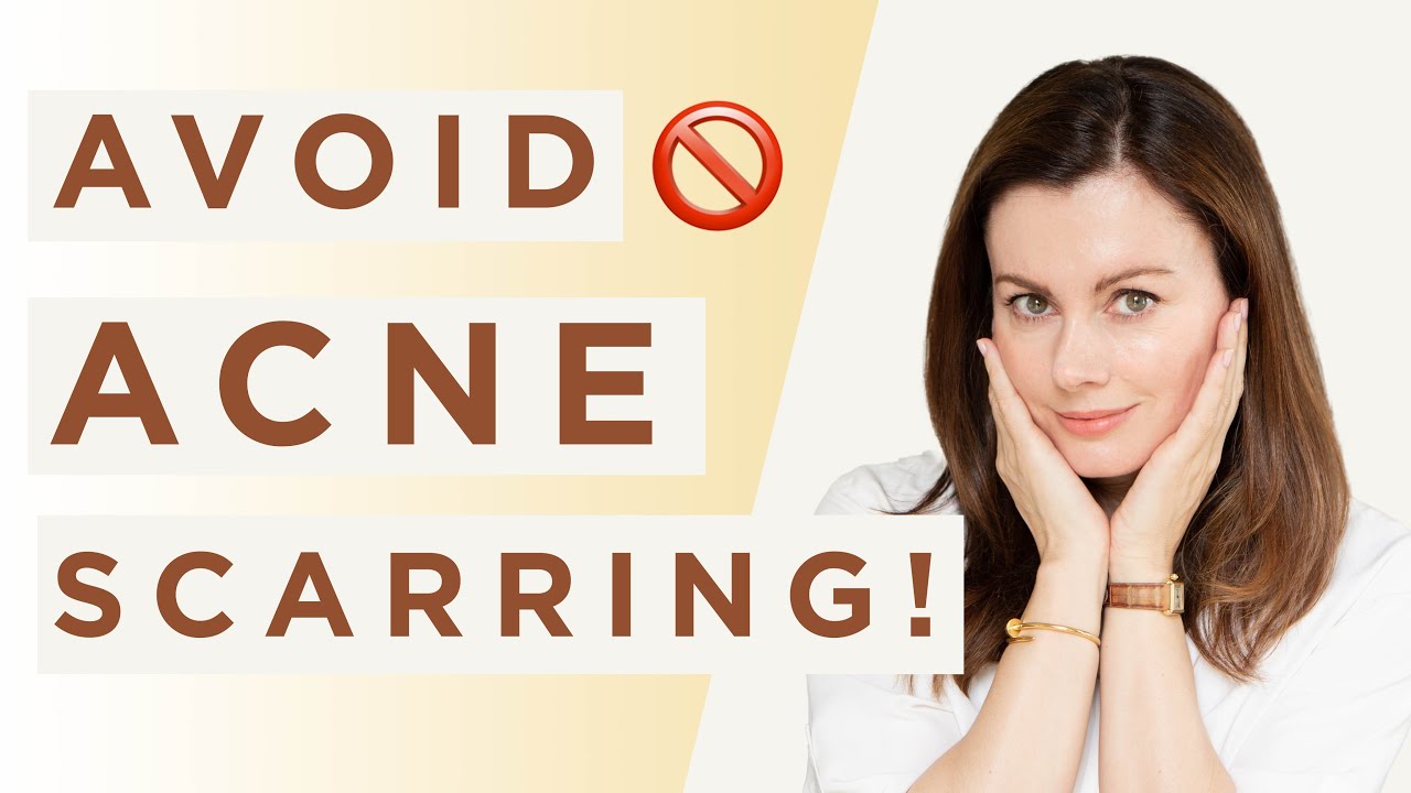 How to Prevent Acne SCARS | Dr Sam Bunting