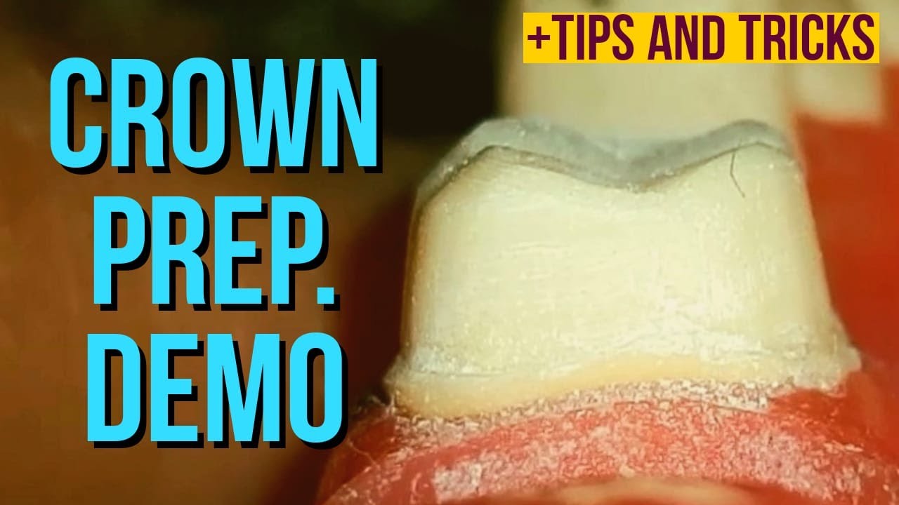 full metal crown preparation on molar demo