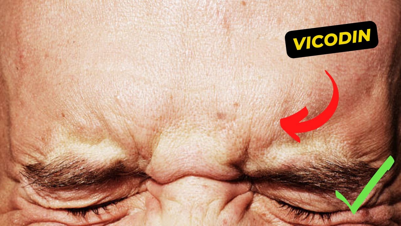 Understanding the Risks and Benefits of Vicodin