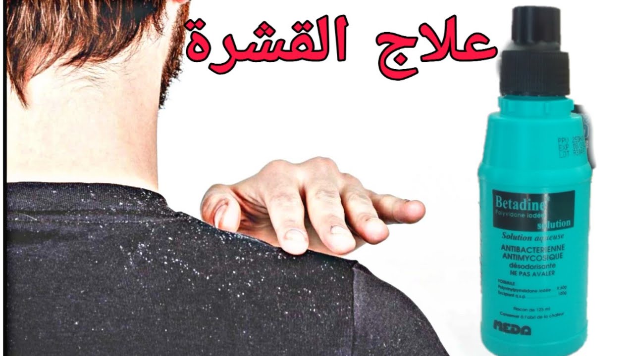افضل علاج القشرة الشعر والحكة بمكون واحد فقط مضمون %100