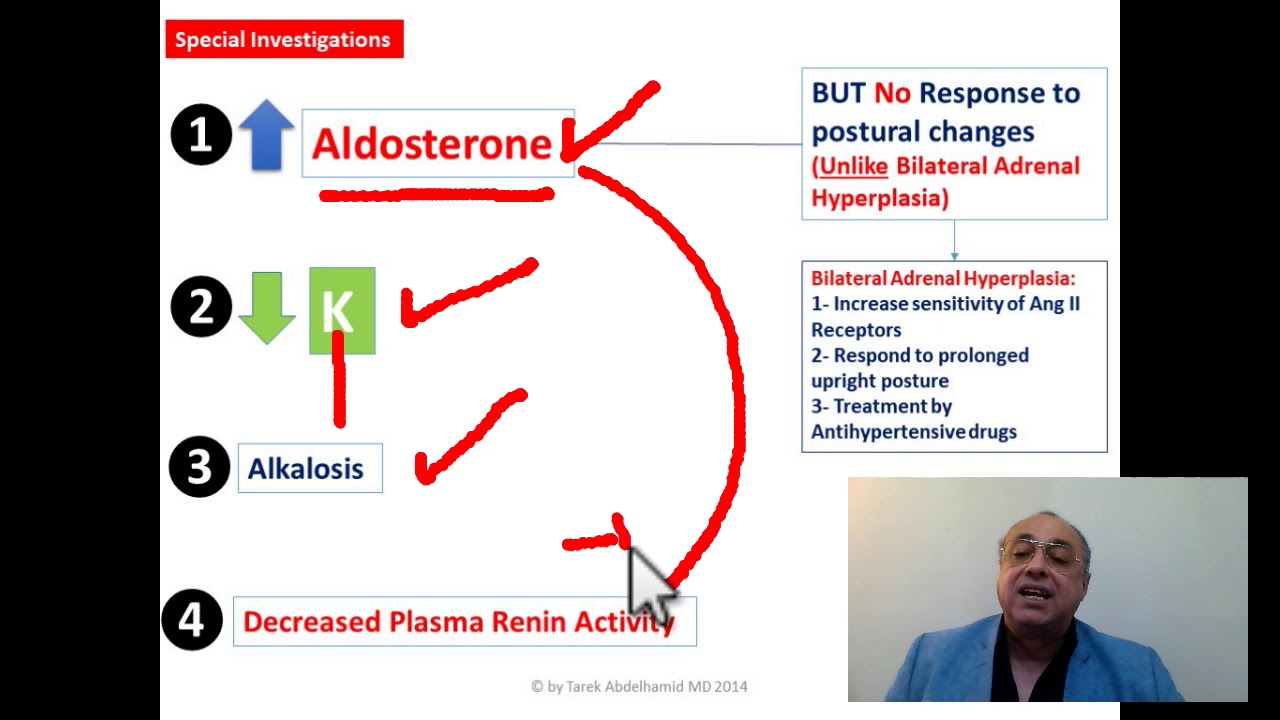 Primary Hyperaldosteronism (Quick Review) #cme #internal_medicine #medicalstudent #محاضرات_باطنة