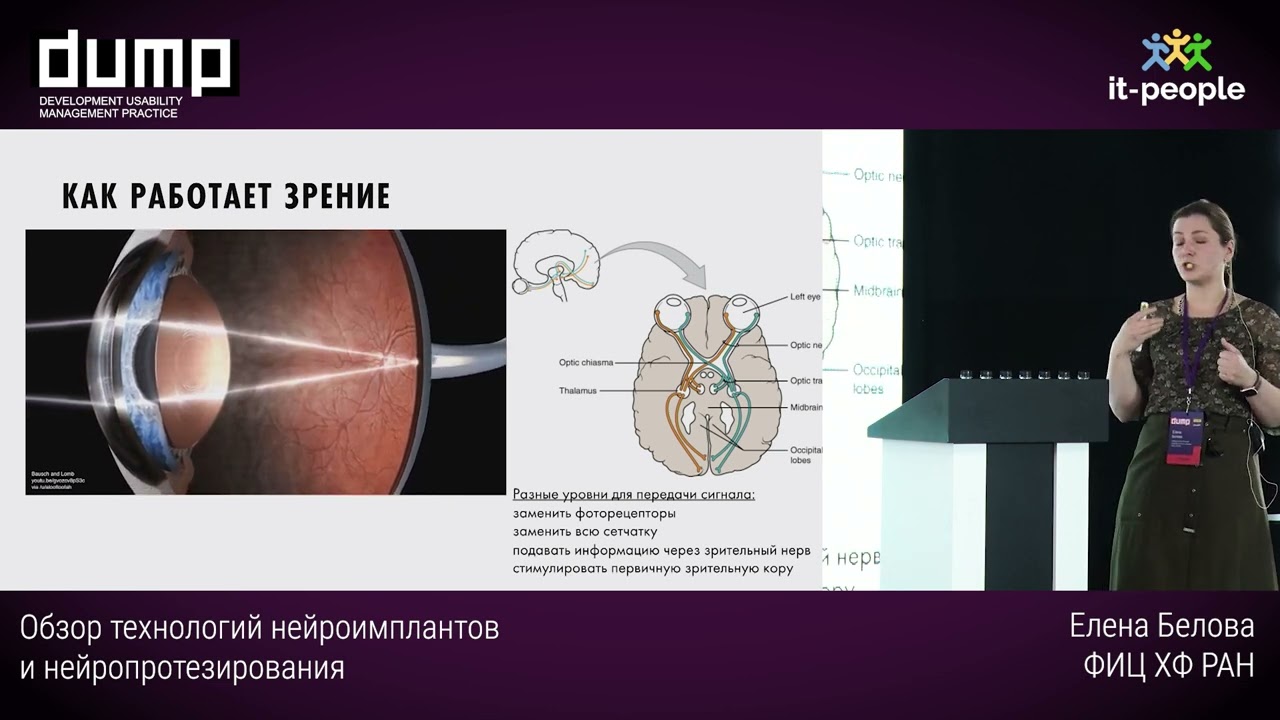 Обзор технологий нейроимплантов и нейропротезирования. Елена Белова, ФИЦ ХФ РАН