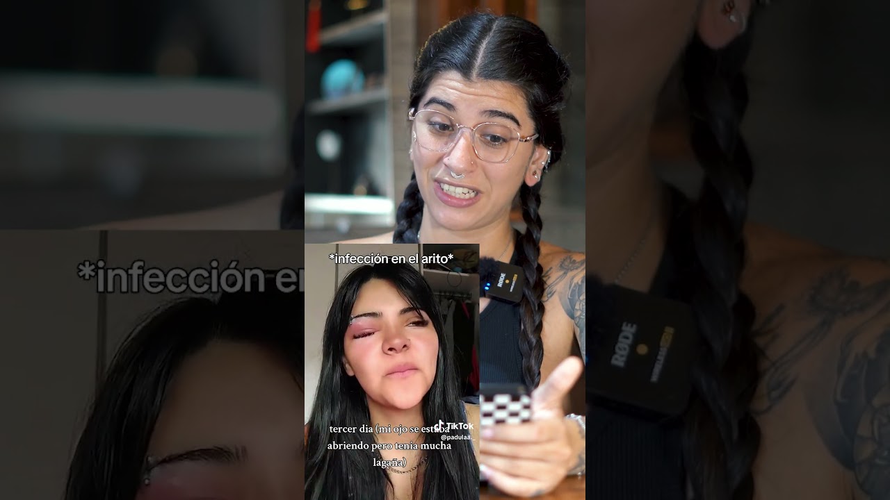 Infecci&oacute;n en el piercing