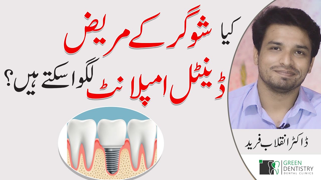 Dental Implant in Diabetic Patient? | Possible or NOT? | Dr. Inqalab Fareed | Urdu | Hindi