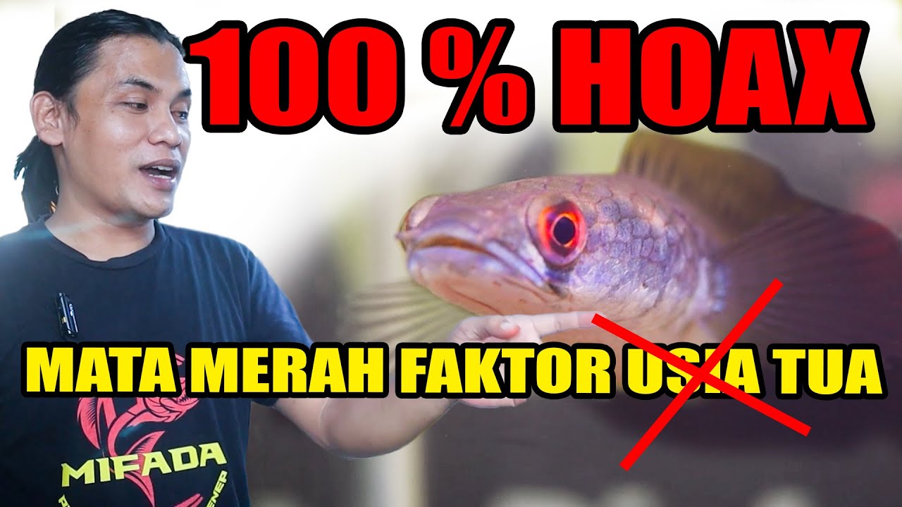 BONGKAR..!! CHANNA MARU MATA MERAH YANG KATANYA FAKTOR USIA