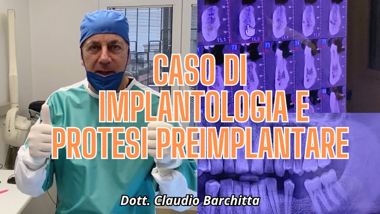 IMPLANTOLOGIA E ORTODONZIA PREINPLANTARE - Dott. Claudio Barchitta