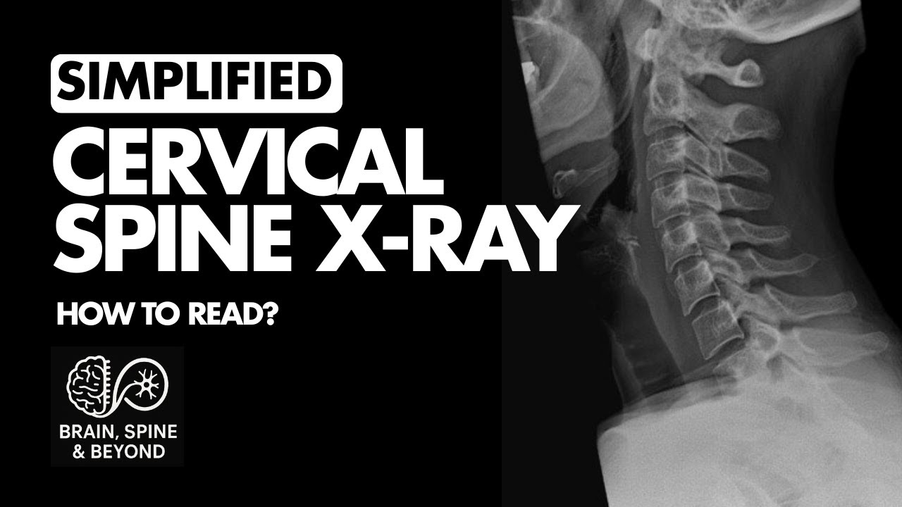 How to Read a Cervical X ray? Normal Anatomy - Simplified Systematic Approach