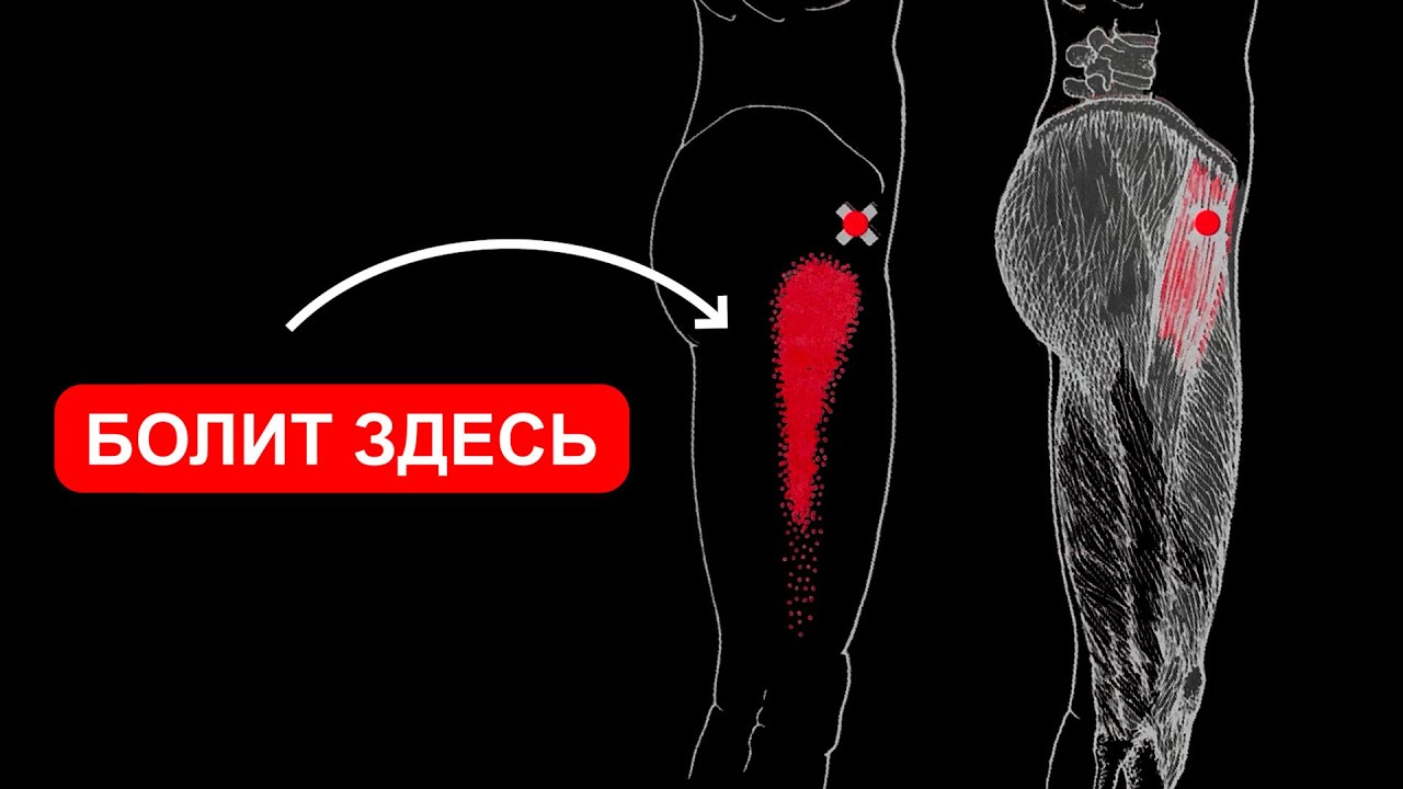 SURVIVE THE SIDE SURFACE OF THE HIP AND THE CELEBRED JOINT 🔴