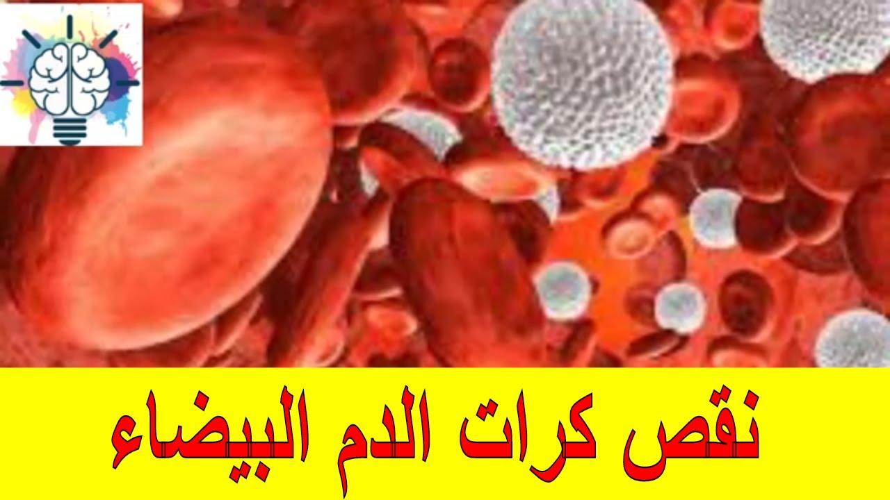 نقص كرات الدم البيضاء اسبابها و طرق زيادتها