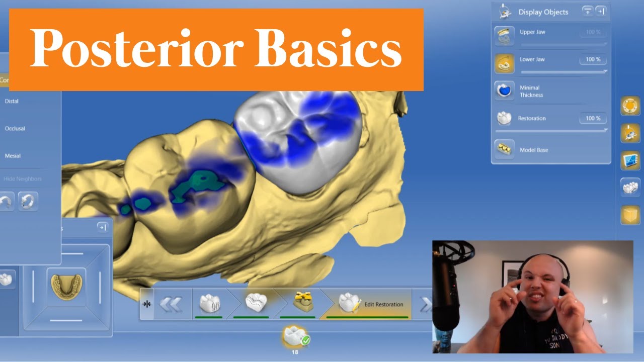 CEREC Stuff: How To DESIGN AND FINISH A Single Unit Posterior - Back To The Basics