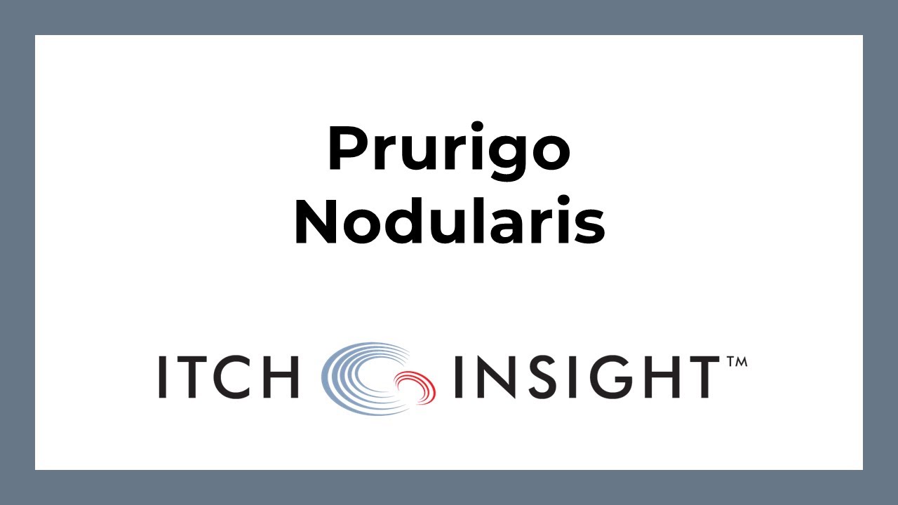 Prurigo Nodularis
