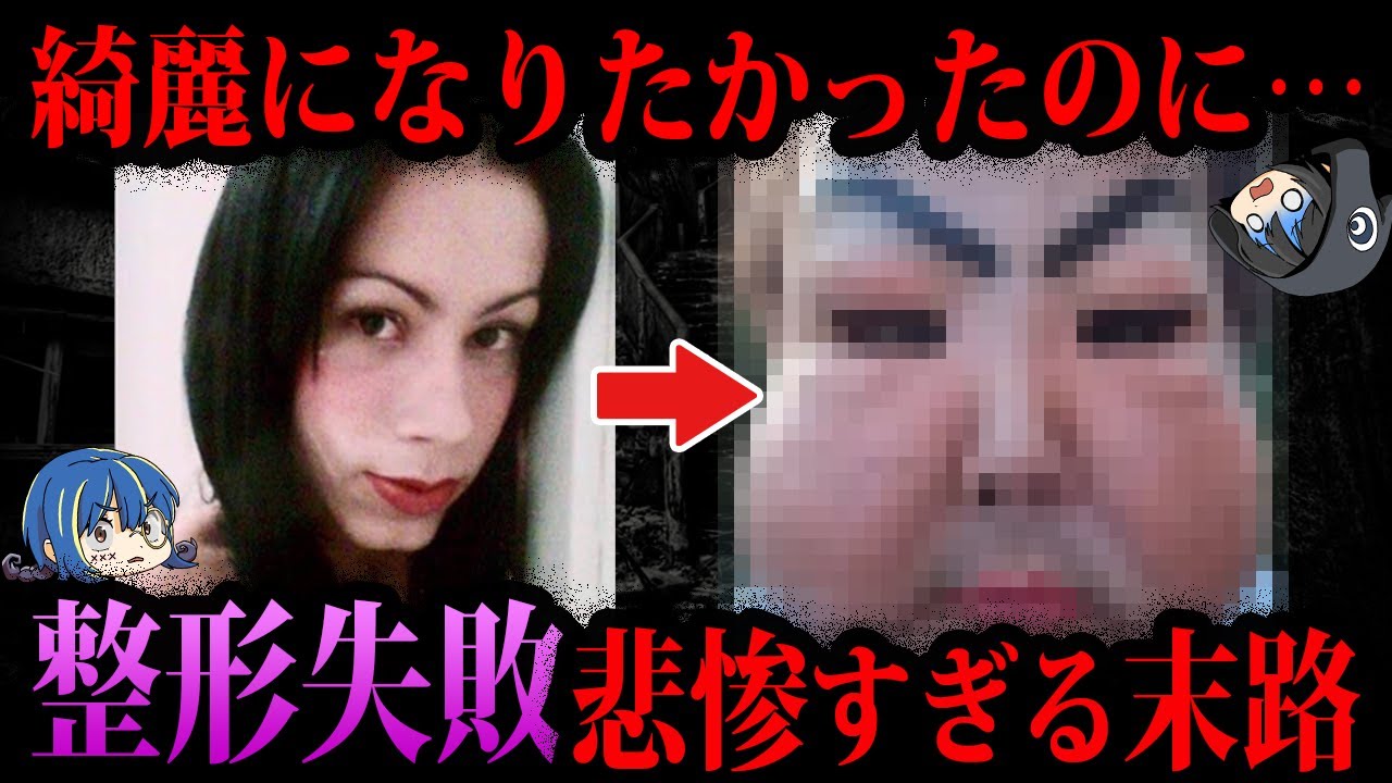 【ゆっくり解説】酷すぎる…整形失敗した悲惨すぎる末路５選