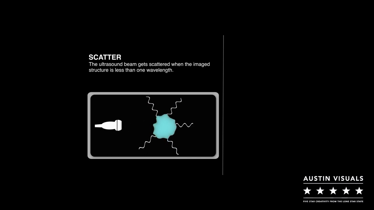 Ultrasound Animation Video | Austin Visuals