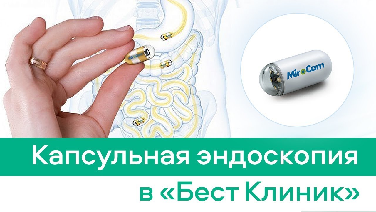 Капсульная эндоскопия в 