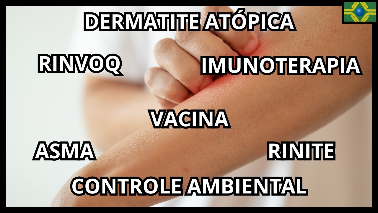 DERMATITE ATÓPICA | IMUNOTERAPIA | VACINA | RINVOQ | RINITE | ASMA | CONTROLE AMBIENTAL