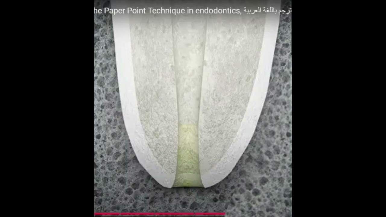 Management of  Open Apex ( Apexification & Regeneration) . Dr. Malek Ashkar
