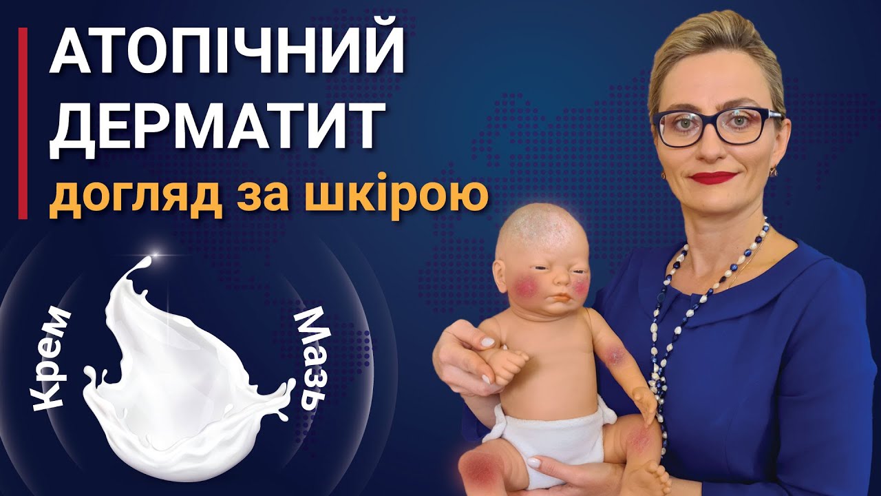Атопічний дерматит у немовлят лікування, причини, догляд за шкірою. Як підібрати крем або мазь? Фото