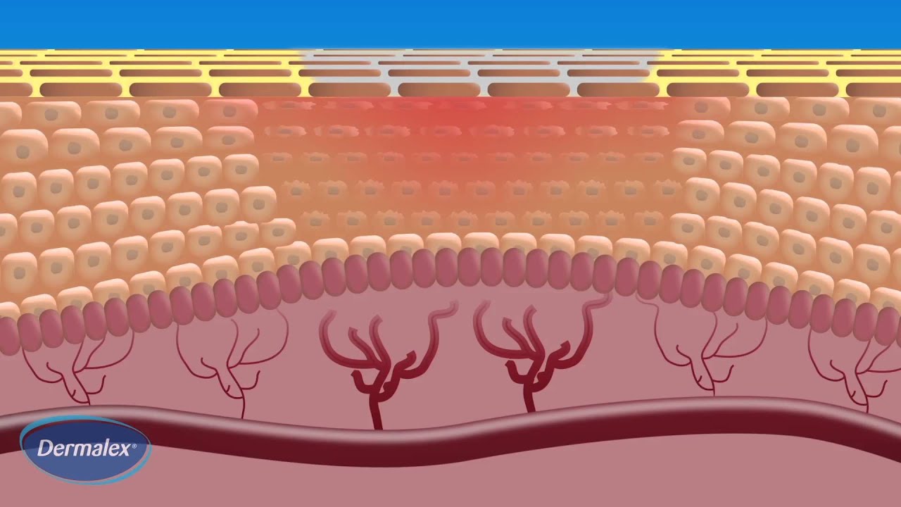 Dermalex Rosacea - How it works