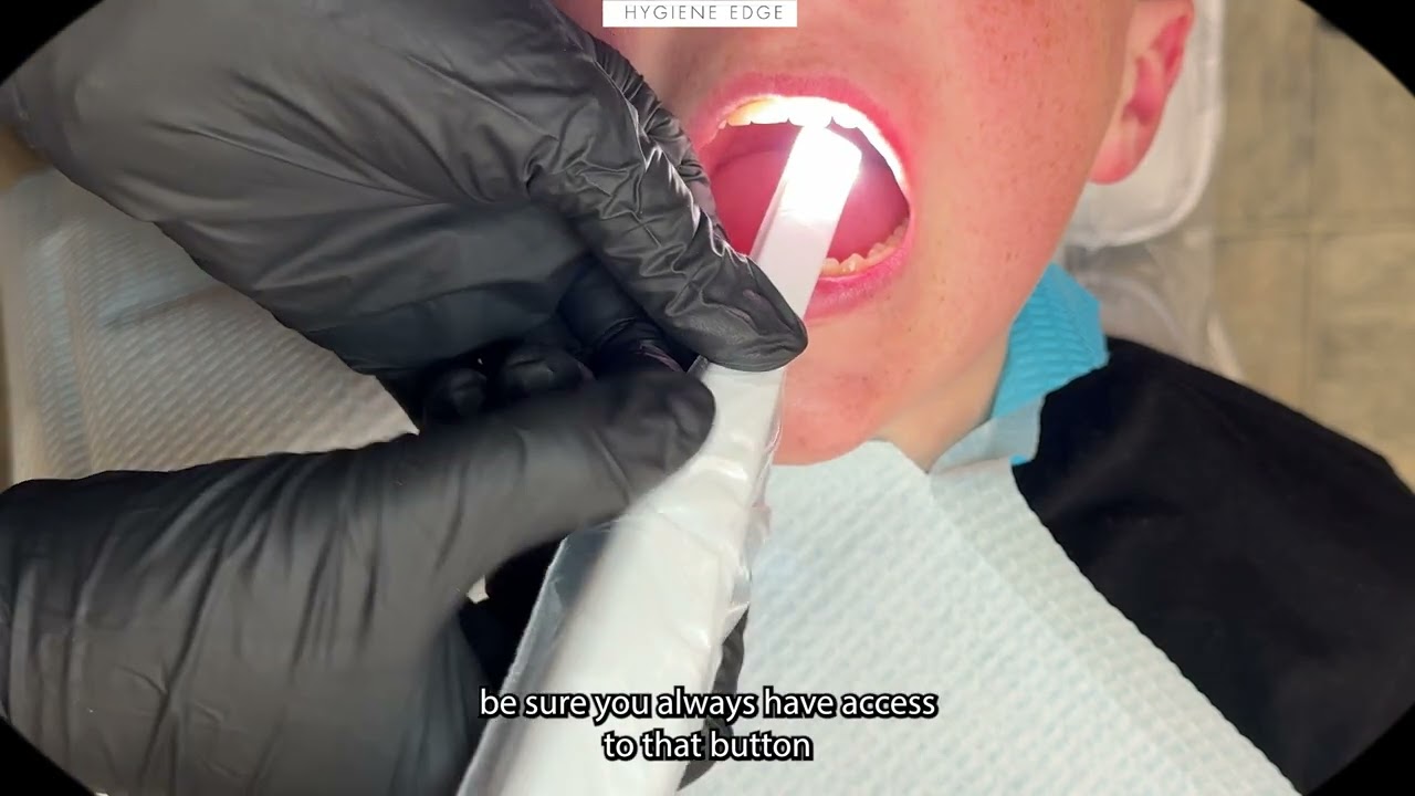 Tips for the Best Intraoral Photo (with Mouthwatch)