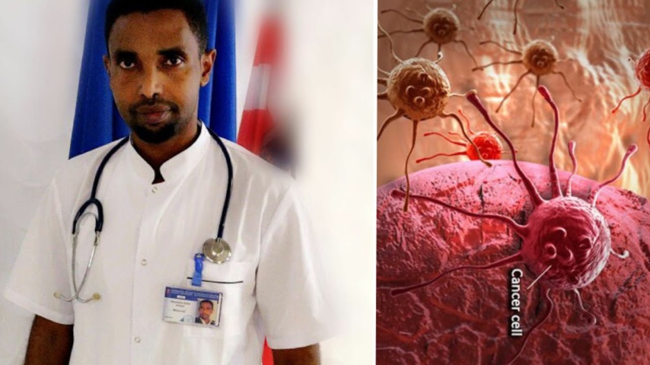 Maxaa Sababa Cudurka Dilaaga ah Ee Cancerka