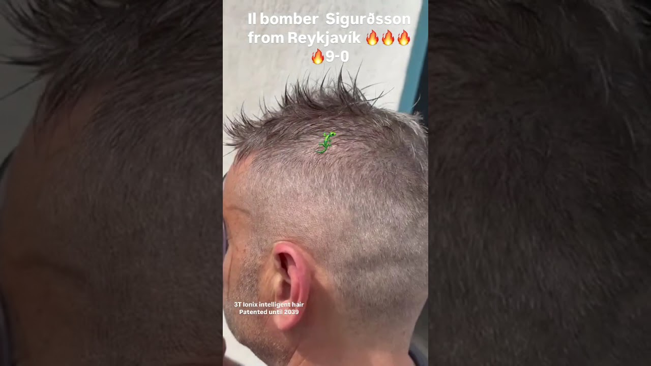 Alopecia:Capelli Intelligenti 3T Ionix stanno diventando la scelta numero uno anche per gli sportivi