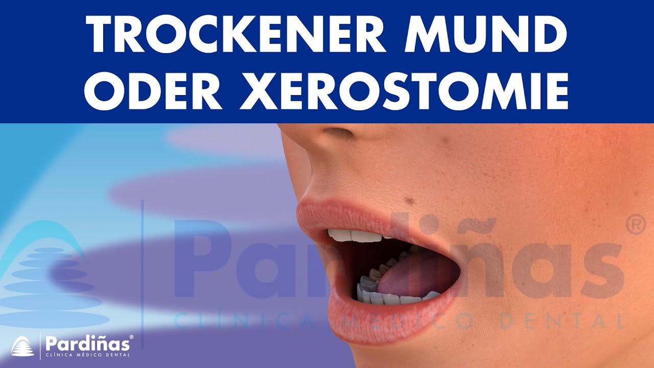 TROCKENER MUND - Ursachen und Abhilfe bei Mundtrockenheit oder Xerostomie ©