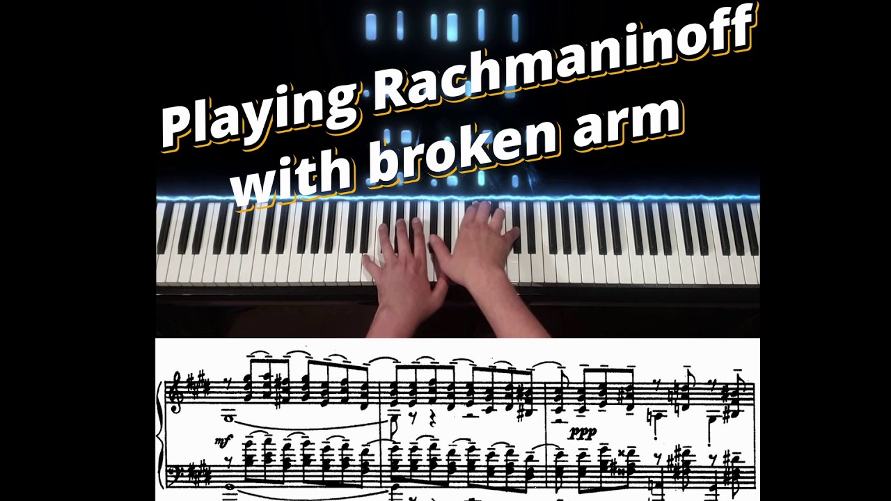 Playing Rachmaninoff with broken arm (Prelude in C# Minor)