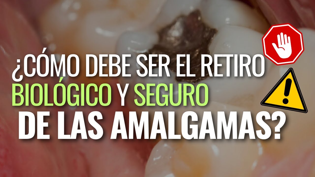 Así es como deben retirar las amalgamas de forma biológica y segura ⚠️🦷👀👆🏻#mercurioamalgama #toxic