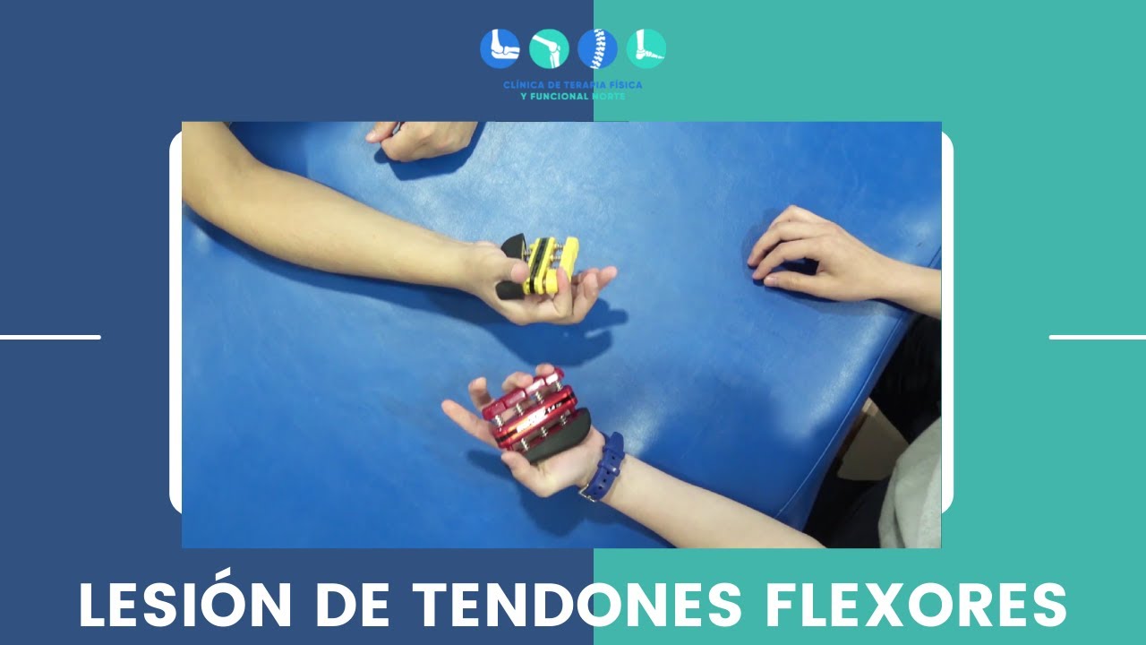 Qué debo hacer si sufrí una lesión de tendones flexores de la mano.
